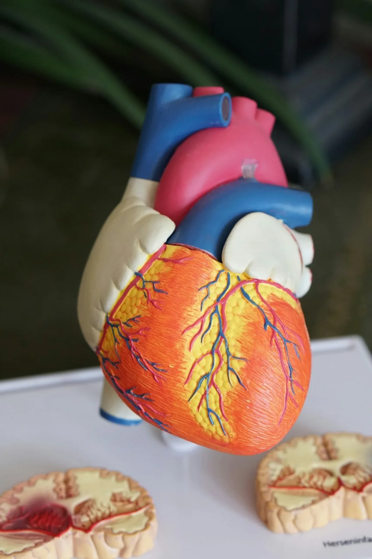 Anatomical model of a human heart showing arteries and veins.